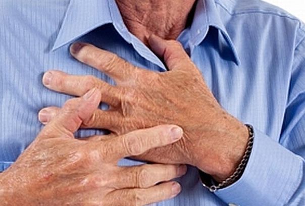 Инфаркт умеет притворяться – и под язву, и под радикулит. инфаркт