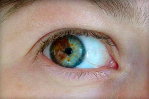 Почему у людей разный цвет глаз и что это значит?