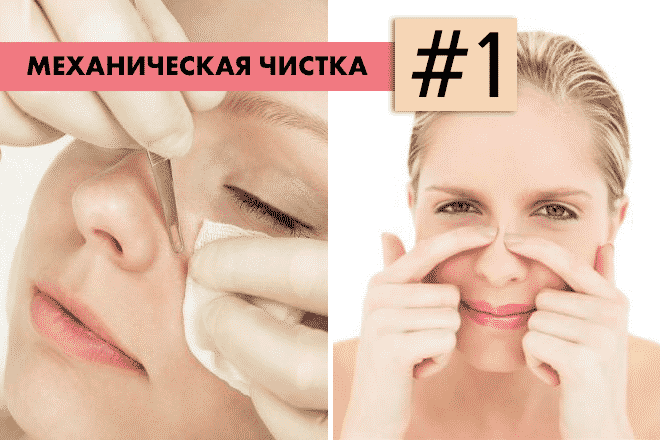 Очищаем нос от черных точек: эффективность vs популярность 