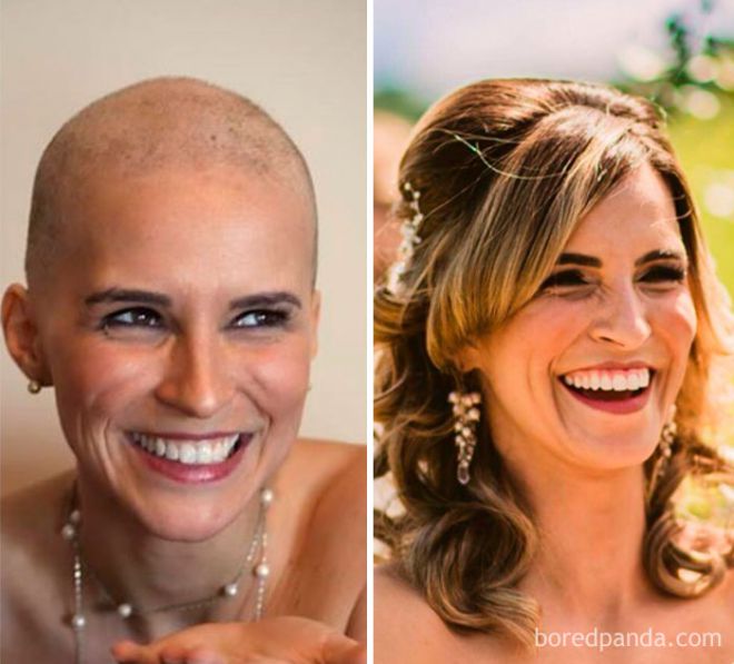 15 воодушевляющих фото людей, победивших рак