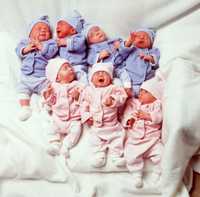Первым в мире выжившим близнецам-семерняшкам исполняется 20 лет!