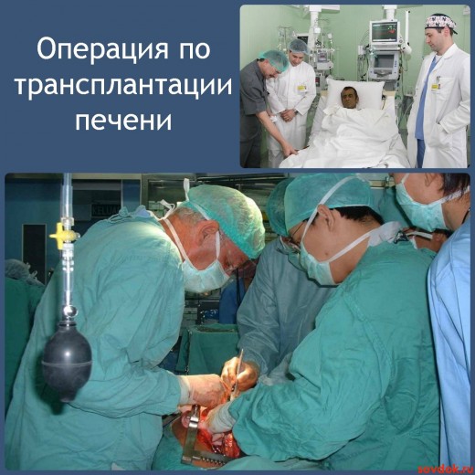 операция по трансплантации печени