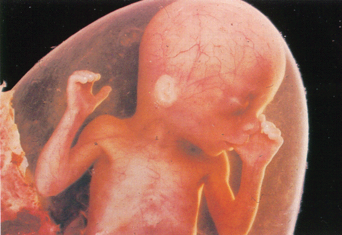 Фото плода на 29 неделе беременности у дам