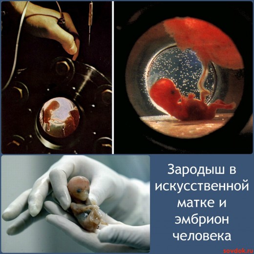 зародыш в искусственной матке и эмбрион человека