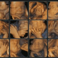 3D и 4D фото плода на 20 неделе беременности