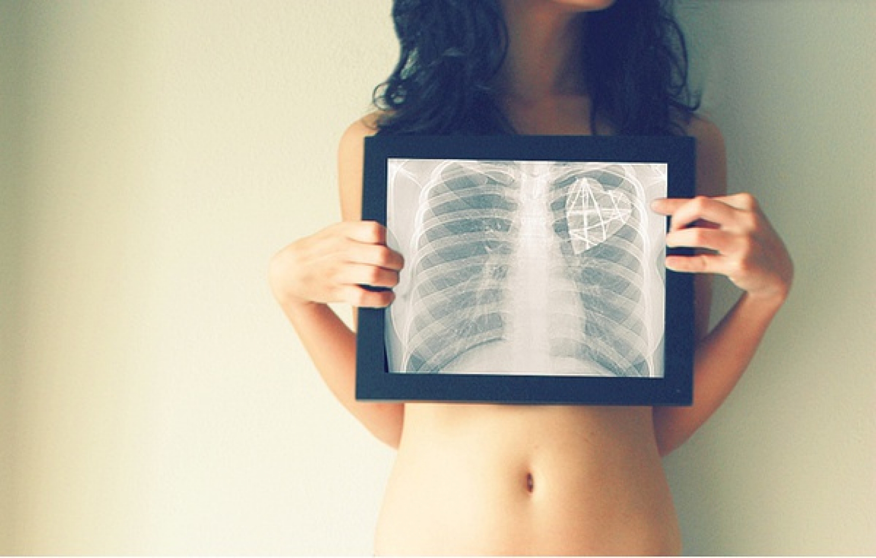 Повреждения грудной клетки – нарушение целостности и функционального состояния костей, мышц корсета и внутренних органов (легких, бронхов, сосудов, сердца, диафрагмы).