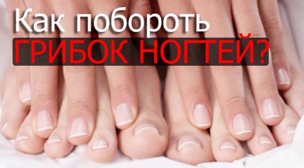 85 Лечение грибка ногтей при помощи Йодинола