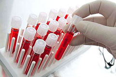 Где сдать анализ крови на антитела