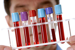 Где сдать анализ крови на сифилис