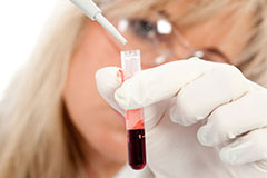 Показатели анализа крови при онкологии