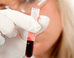 Анализ крови на краснуху