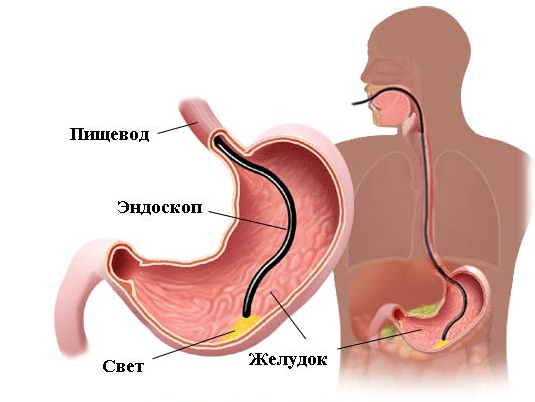 Обследование на наличие заболевания