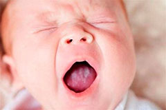 Симптомы молочницы у новорожденных