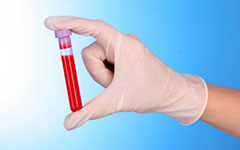 Общий анализ крови на билирубин
