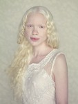 Девочка альбинос
