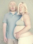 Мужчина и женщмна альбиносы