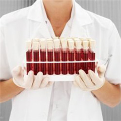 Анализ крови на определение группы крови 