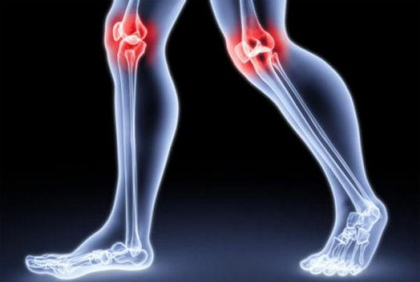 артрит колена