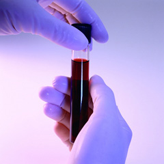 Биохимический анализ крови на АЛТ