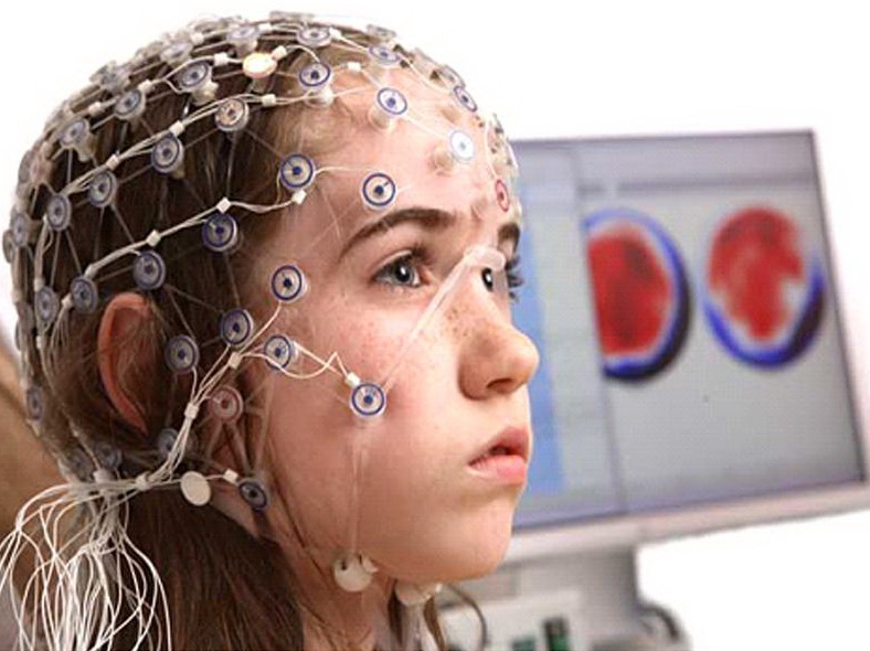 Эпилепсия у детей - патология головного мозга, характеризуется неоднократными приступами, которые случаются без очевидных провоцирующих обстоятельств.