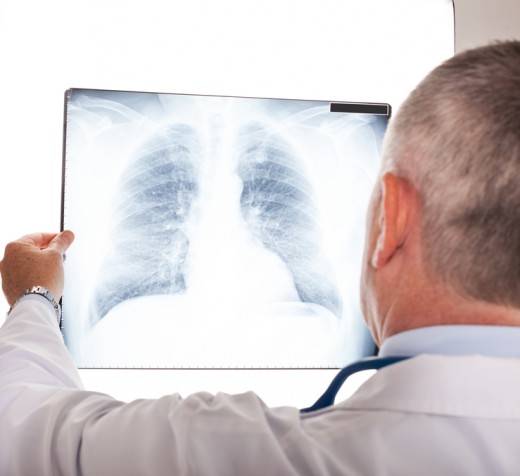 рентгеновский снимок лёгких