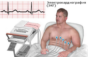 ЭКГ информирует о состоянии миокарда, ритма и проводимости сердца
