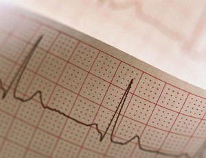 Электрокардиограмма покажет состояние вашего сердца