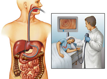 Эндоскоп проникает в желудок пациента