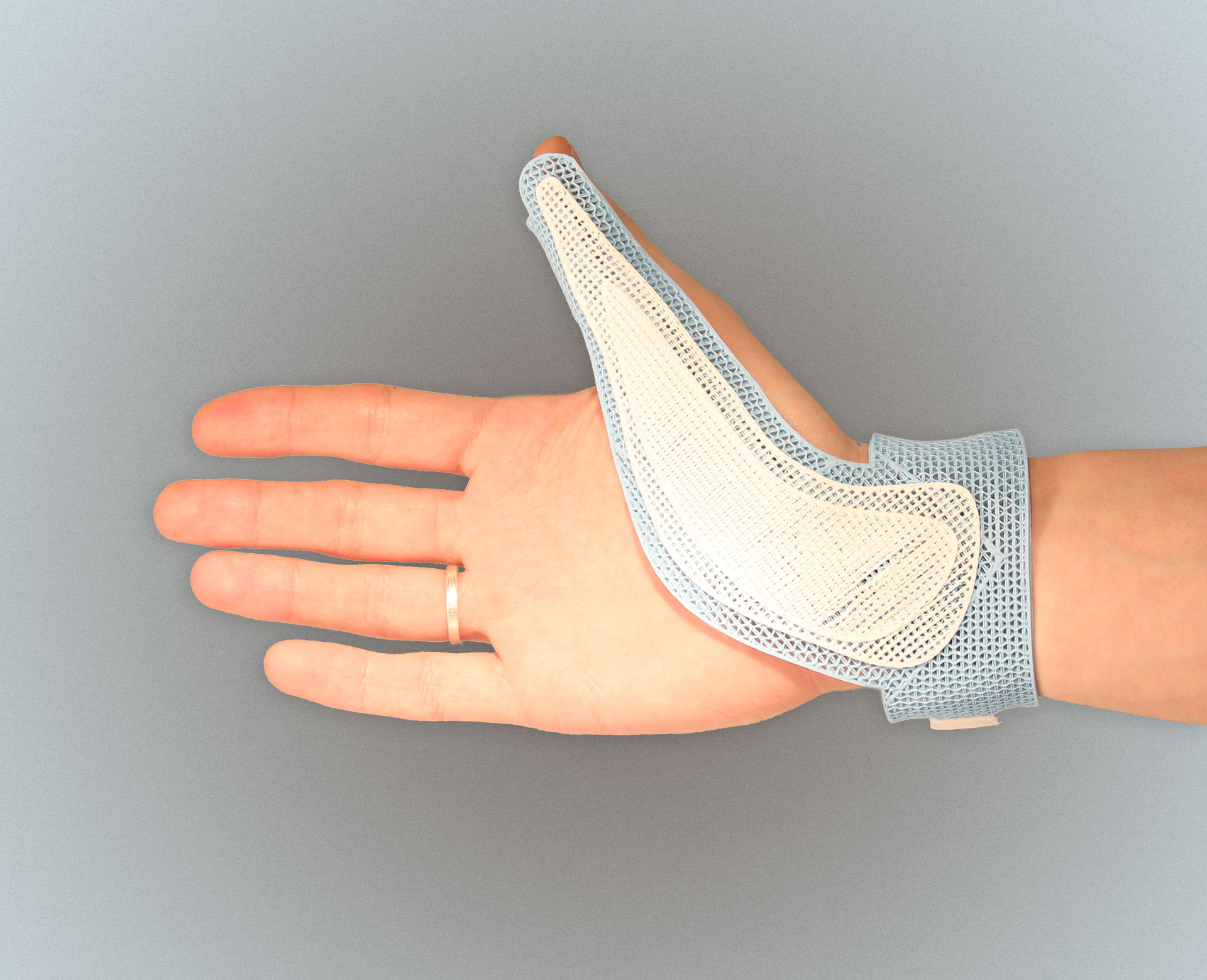 Вывих пальца – смещение костей суставов, которое часто сопровождается разрывом связок и суставной сумки.