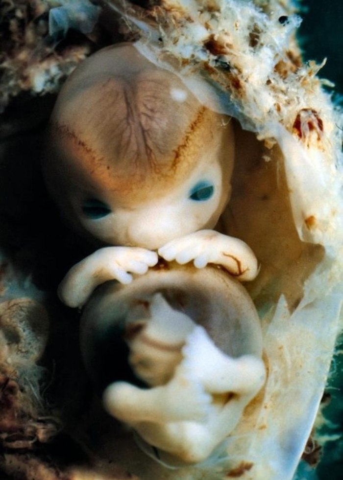 Фото эмбриона человека на 7 неделе развития