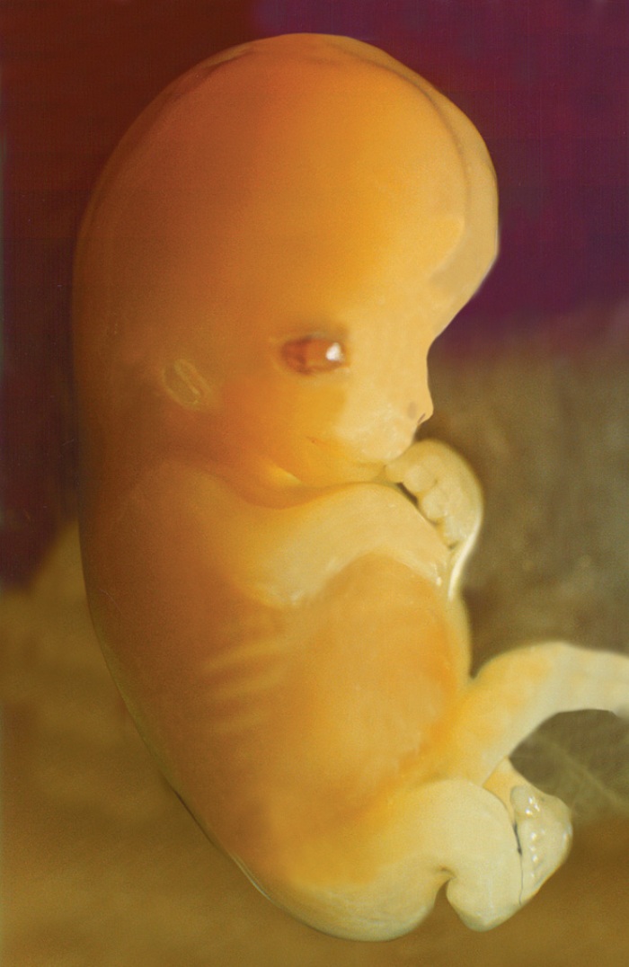 Фото плода на 7 неделе беременности