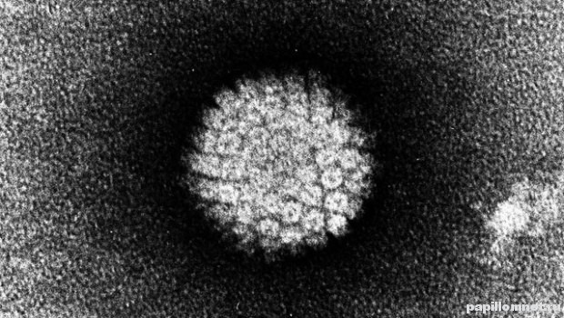 Фото вируса папилломы человека который является причиной образования кондилом