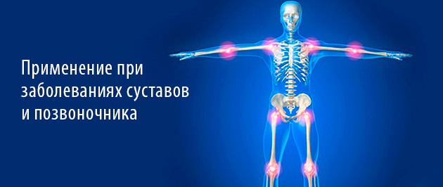 мазь с ибупрофеном для суставов