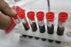 ИФА анализ крови на паразитов 