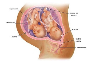 Сроки беременности двойней