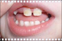 Больные зубки 