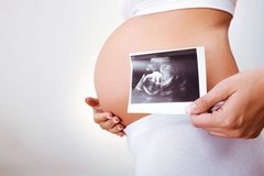 Плановые УЗИ при беременности