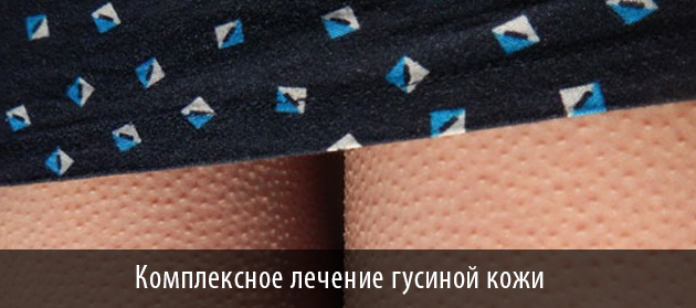 комплексное лечение