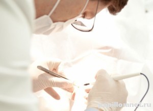 Фото врача в процессе процедуры лазерного удаления кондиломы у женщины