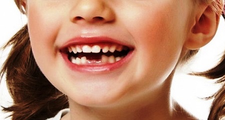 Коренные зубы у детей: симптомы прорезывания