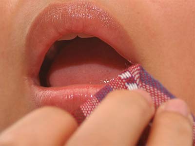 лечение герпеса на губе