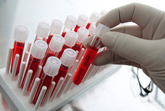 Лейкоциты в общем анализе крови