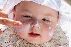 Мазь от аллергии для детей