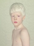 Мальчик альбинос