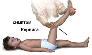 менингит