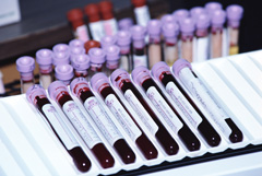 Нормальные показатели биохимического анализа крови