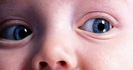Опух глаз у ребенка: возможные причины