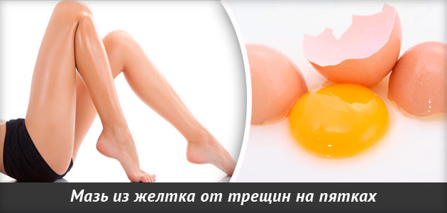 народные средства от трещин на пятках