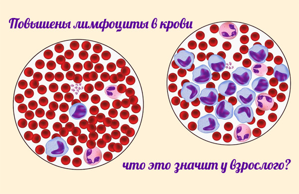 повышенные лимфоциты в крови