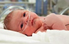 Последствия гипоксии у новорожденных